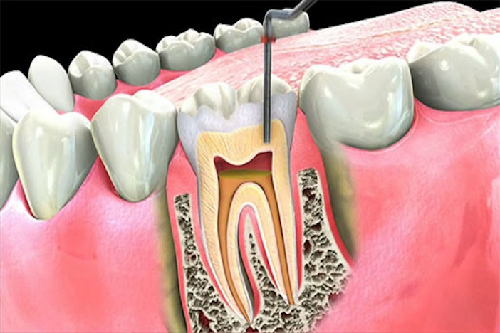 Comprehensive Guide to General Dentistry Services In Las Vegas