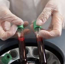 Best Diagnostic Centres in Vellore: Your One-Stop Destination for Accurate Results