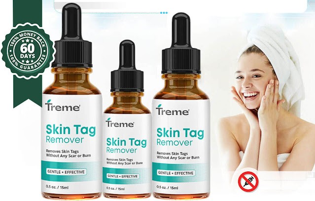 What is Treme Skin Tag Remover used for?