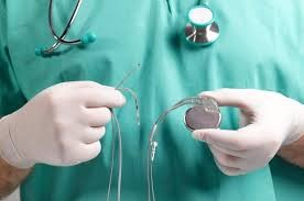 Cardiac Bio Implant Devices Market Analysis Size And Forecast Report 2024-2032