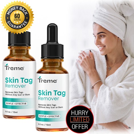 Treme Skin Tag Remover "Official Website" Review & Price For Sale