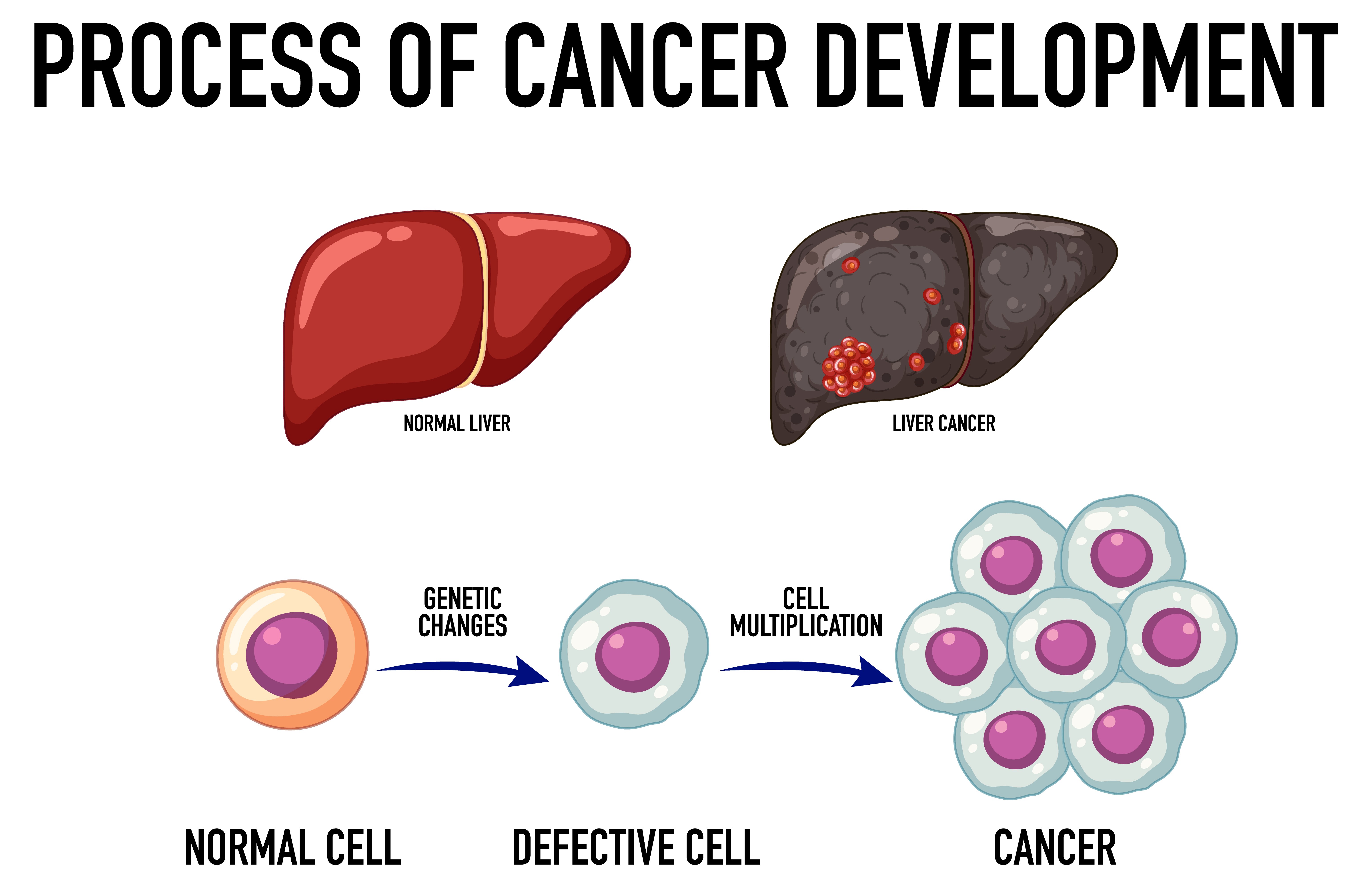 Comprehensive Pancreatic Cancer Care in India: Your Guide to Expert Treatment