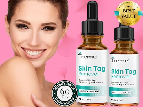 Treme Skin (Moles & Wart Remover) Reviews & How To Use?