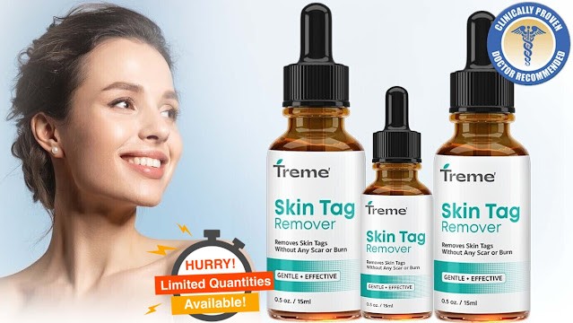 Transform Your Skin - Treme Skin Tag Remover Serum (Moles & Wart Remover)