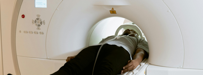 Myocardial Perfusion Imaging Scan | MPI Scan in Bangalore