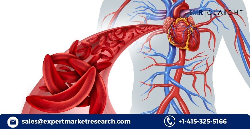 Sickle Cell Disease Drug Pipeline Analysis Report: Demand Forecast and Future Outlook (2034)
