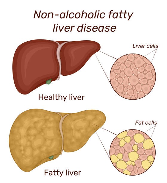 Navigating Growth: Insights into the Fatty Alcohol Market
