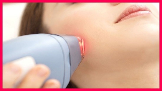 Competitive Landscape and Strategic Developments in the Aesthetic Lasers Market